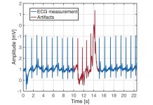 Accurate Monitoring of Cardiovascular Activity