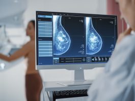 UT Southwestern Medical Center experts have created an advanced AI tool that detects metastatic breast cancer accurately.