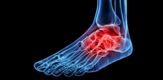 fracture-related infections